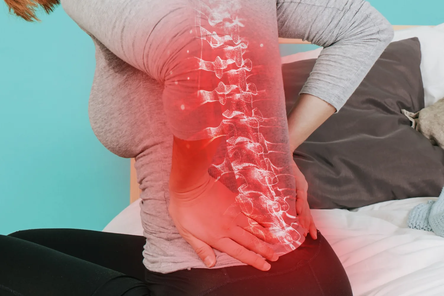 Espondilolistesis